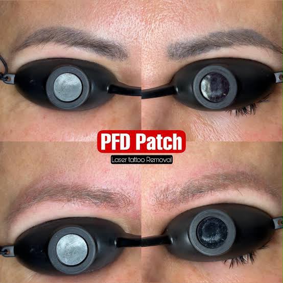 PFD SKIN PROTECTION PATCH