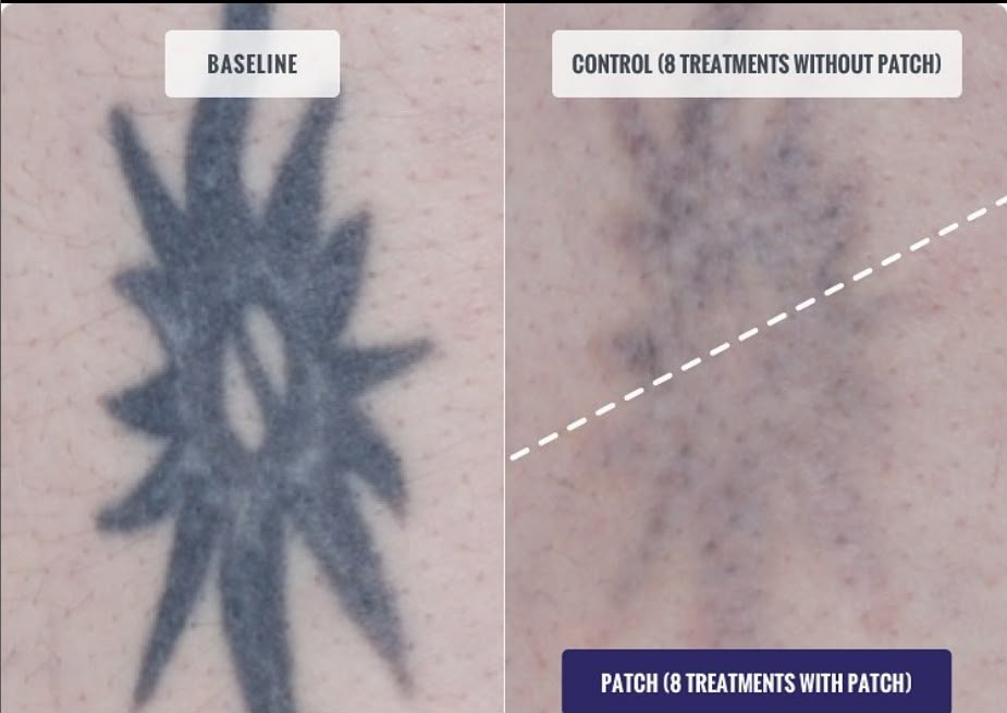 PFD SKIN PROTECTION PATCH