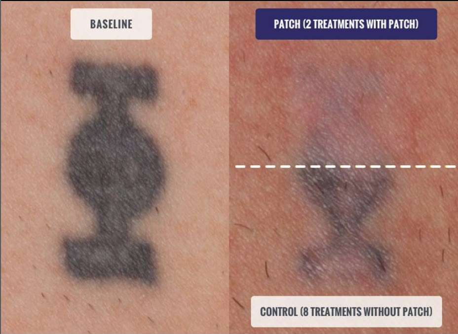 PFD SKIN PROTECTION PATCH