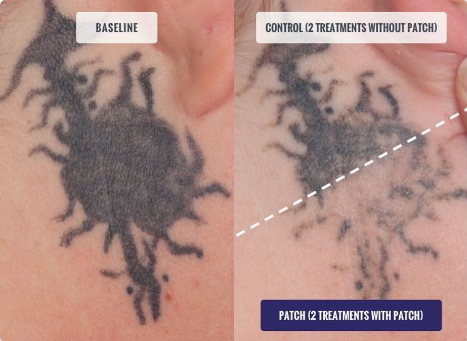 PFD SKIN PROTECTION PATCH