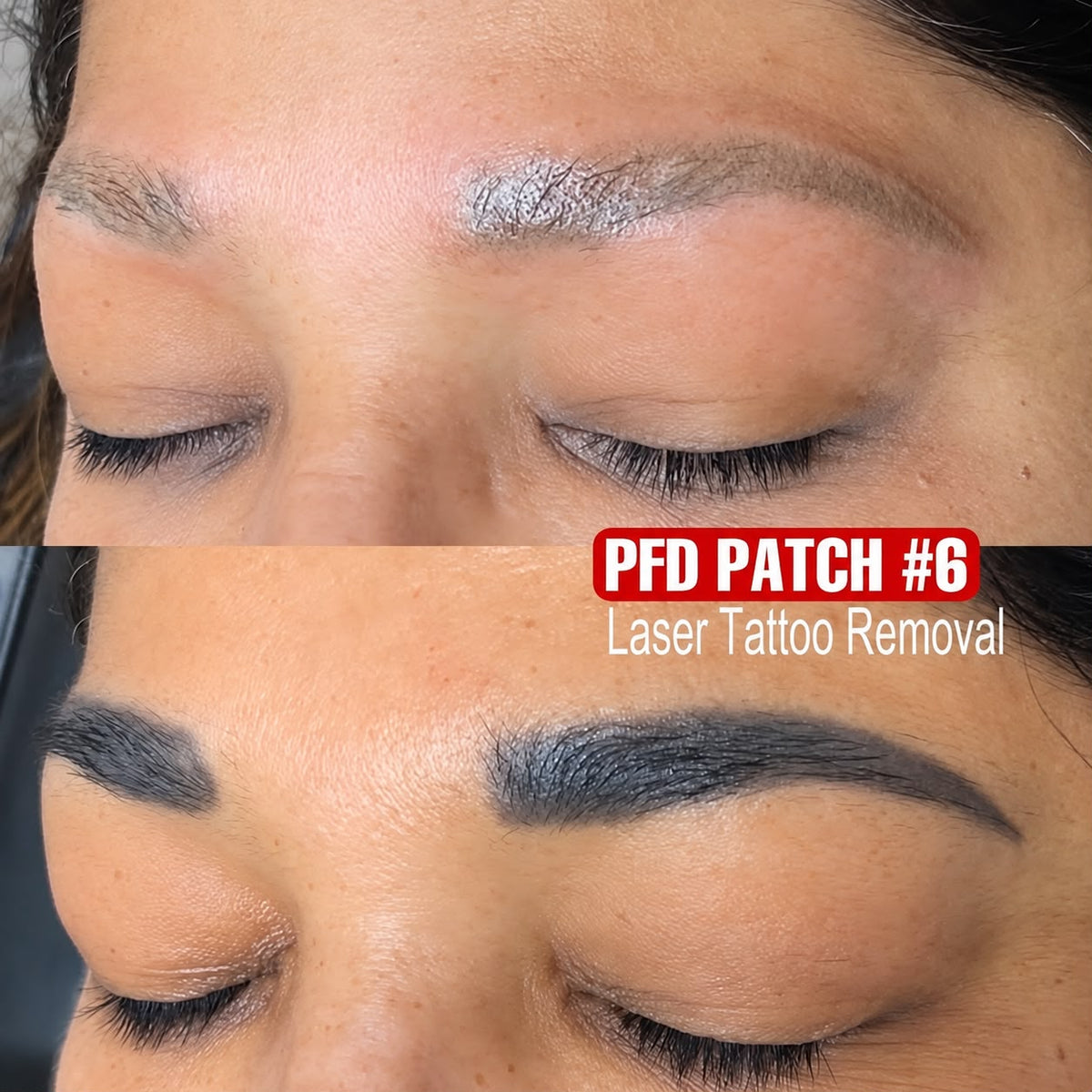 PFD SKIN PROTECTION PATCH